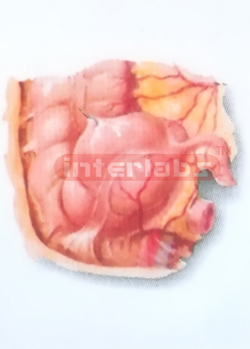 HUMAN HEALTH CECUM AND VERMIFORM APPENDIX MODEL